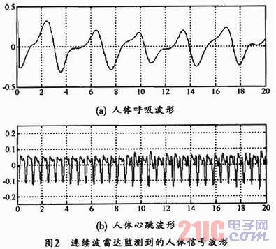 基于matlab软件心跳呼吸模型的仿真设计