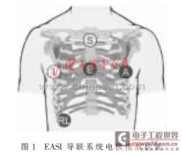 holter位置图片,holter佩戴示意图 基于dsp的easi十二导联多功能holter系统