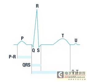 心电信号波形