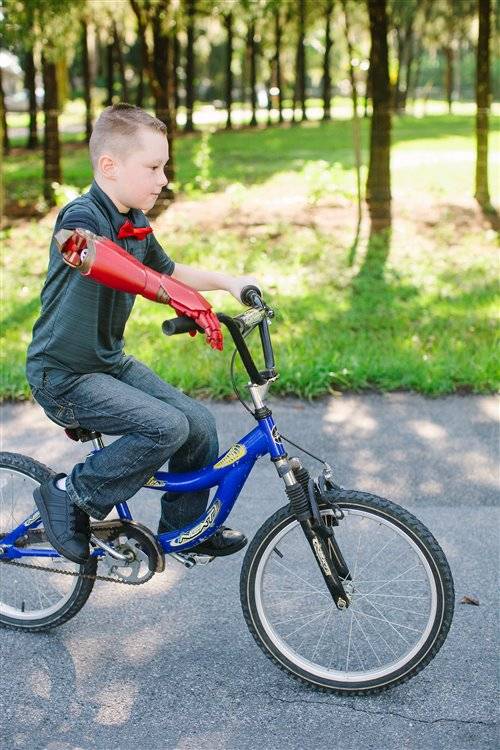 仿生义肢成就残疾儿童的超级英雄梦